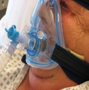 Abb1: In der Entwöhnungsphase vom Beatmungsgerät wird oftmals eine nichtinvasive Maskenbeatmung eingesetzt.