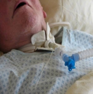 Abb2: Dieser Patient wird im Entwöhnungsprozess über ein Tracheostoma (Luftröhrenschnitt) beatmet. Hierbei kann der Patient ggf. während Spontanatmungsphasen wieder sprechen.